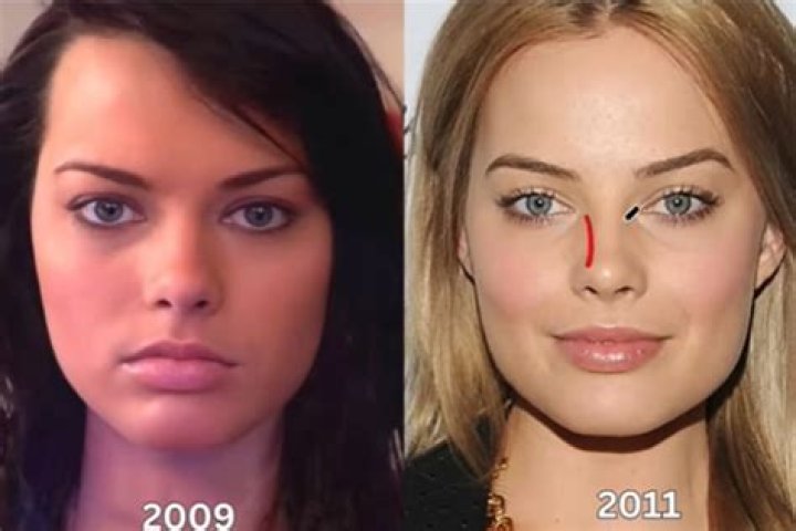 Billie Lee Before And After: Did She Have Surgery?