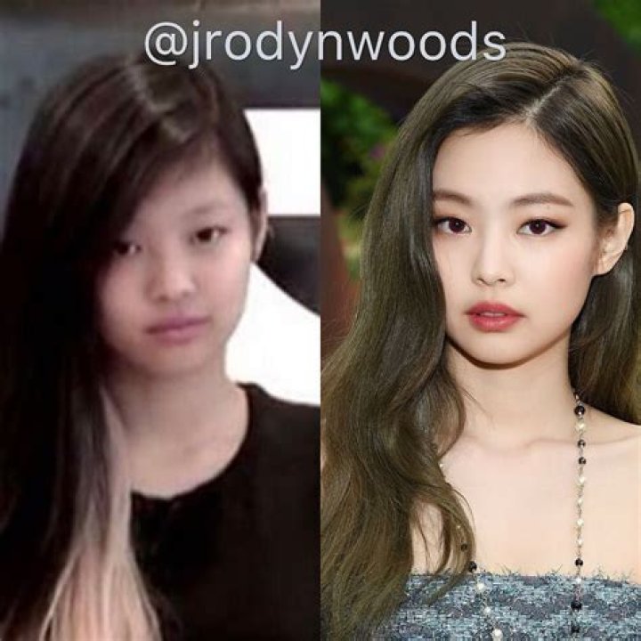 Did Jennie from Blackpink Get Plastic Surgery? A Look into Some Speculations