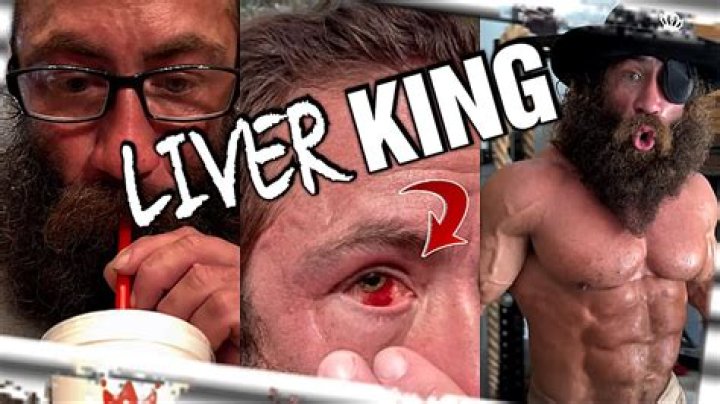 Liver King Eye Injury: What Happened To His Eye?