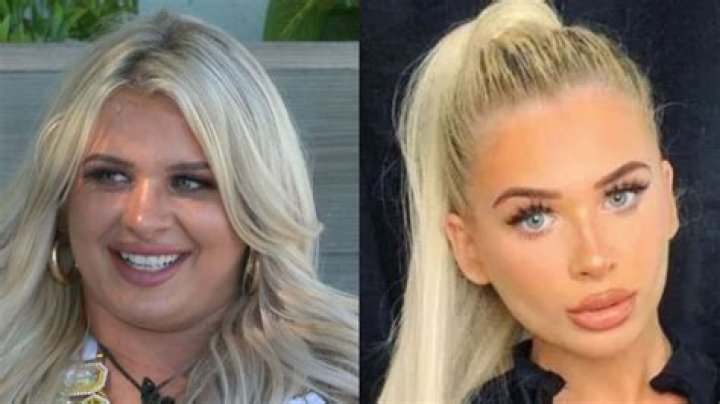 Mal Love Island Before Surgery | Mal Nicol Before And After Photos